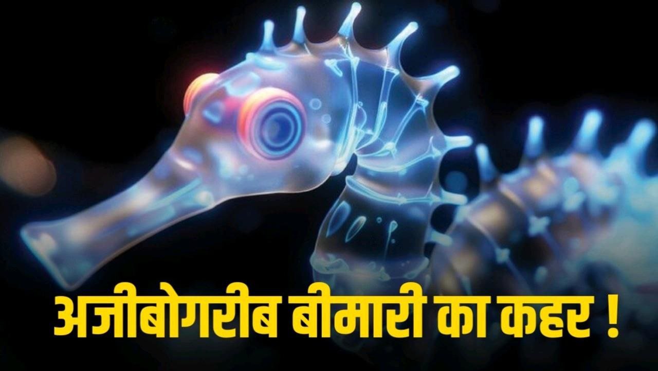 छिन्दवाड़ा में अजीबोगरीब बीमारी अब तक 3 बच्चों की मौत Madhya Pradesh